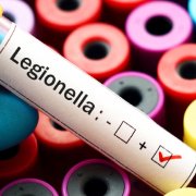 legionella