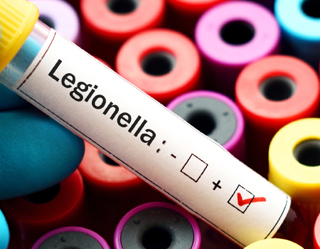 legionella