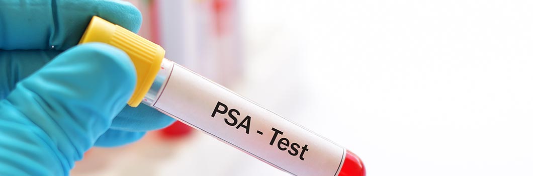 psa test