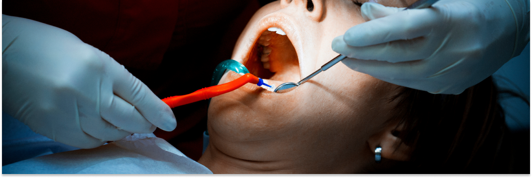 jak leczyć ropień zęba