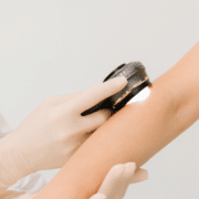 co to jest dermatoskopia