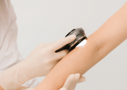 co to jest dermatoskopia