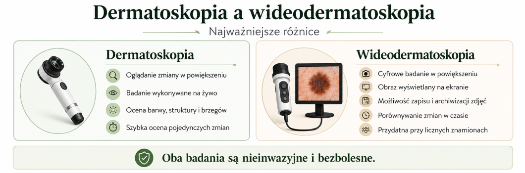 wideodermatoskopia a dermatoskopia
